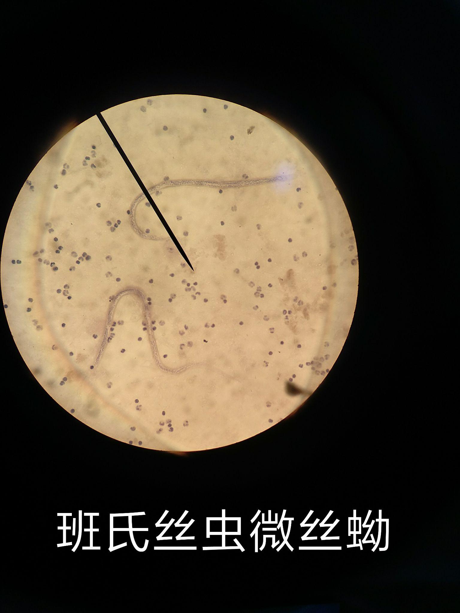 |	袵Iu胱&_爢蚴的简单介绍