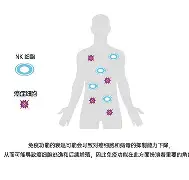 nk细胞的作用与功效 nk细胞的作用与功效